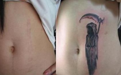 南京哪家醫(yī)院做隆鼻好？選擇哪家醫(yī)院效果最好，價(jià)格又合理又安全