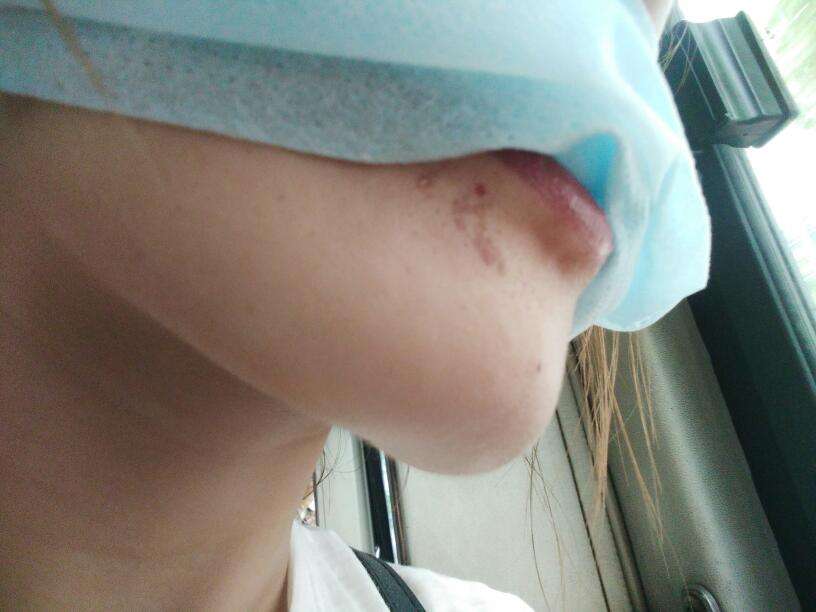 2023濟(jì)南激光溶脂瘦后背榜單前10位專家(李罡、史玉蕾、薛云鵬這些正規(guī)醫(yī)生推薦給你)