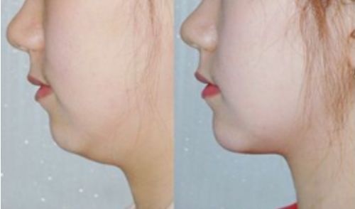 山東臨沂整容醫(yī)院排行榜及綜合評(píng)價(jià)：哪家好？