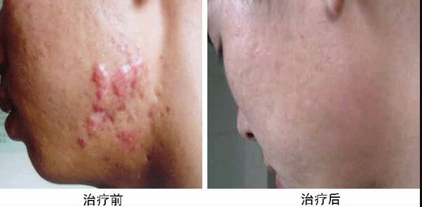 合肥哪家整容醫(yī)院雙眼皮做得好？專業(yè)整形外科專家推薦