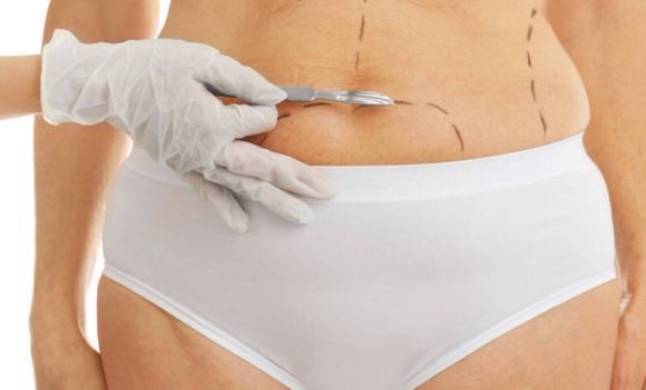 自貢哪家醫(yī)院做雙眼皮效果好？