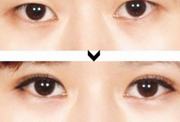 寧夏整形醫(yī)院哪家好？綜合評(píng)測(cè)，推薦您最滿意的整形醫(yī)院