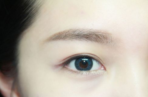 寧波哪家醫(yī)院割雙眼皮效果好？