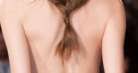 寧波胡文俞吸脂技術靠譜嗎？