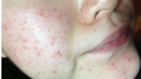 北京豐臺(tái)右安門醫(yī)院醫(yī)生好不好？服務(wù)口碑如何？