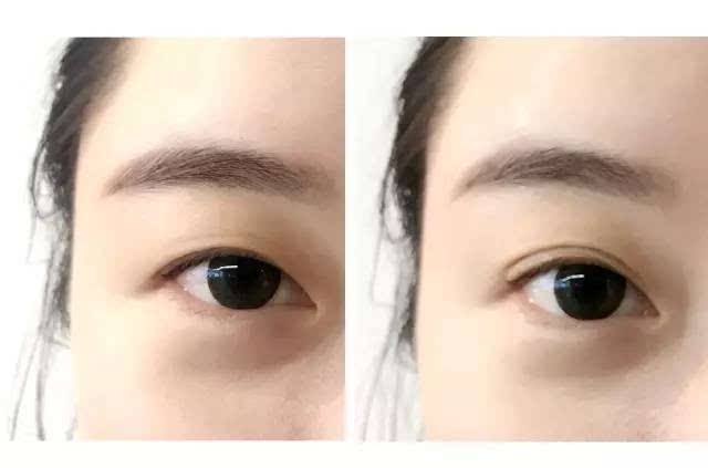 2023成都肉毒素填充術(shù)專家排名top10強(qiáng)(羅承惠、林陽華、劉中國實(shí)打?qū)嵉目诒?