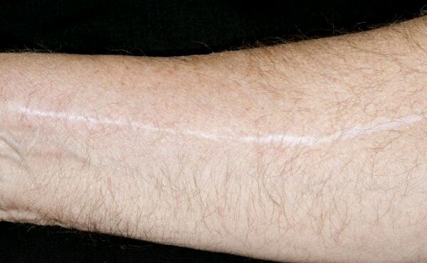 2023成都膠原蛋白去木偶紋醫(yī)生TOP10口碑榜(苗劉玉、周齊鳴、陳謝娟價格收費不稀奇~)