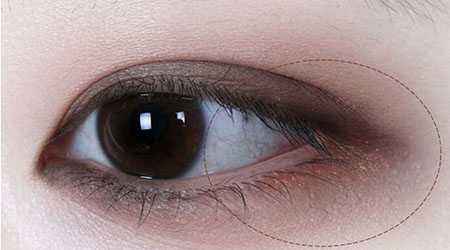 2023濟(jì)南5s重瞼術(shù)權(quán)威醫(yī)生口碑TOP10(于杰、張義晨、王標(biāo)多方面出擊入圍榜單)