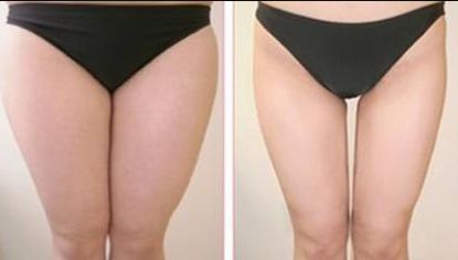 如何評價(jià)廣州珈禾整形醫(yī)院的口碑和質(zhì)量？