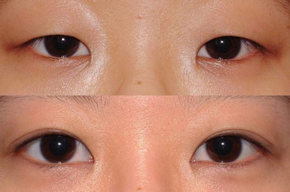 蘇州打瘦臉針哪家醫(yī)院好？2023年蘇州瘦臉針治療排行榜發(fā)布