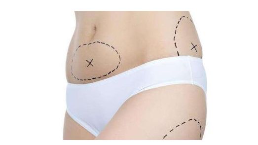 上海哪家醫(yī)院的祛眼袋手術(shù)效果最好？讓您的眼睛重獲明亮與青春