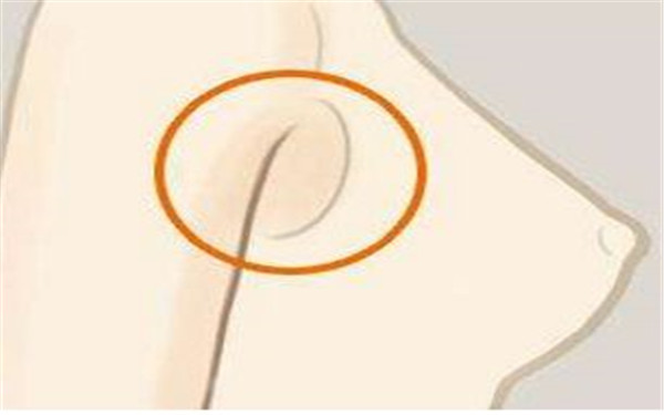 范巨峰醫(yī)生個(gè)人故事：驚艷雙眼皮案例與專業(yè)實(shí)力！