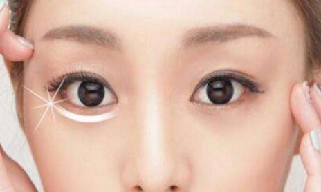 荊州割眼袋哪家醫(yī)院好？眼袋修復專家為您推薦！