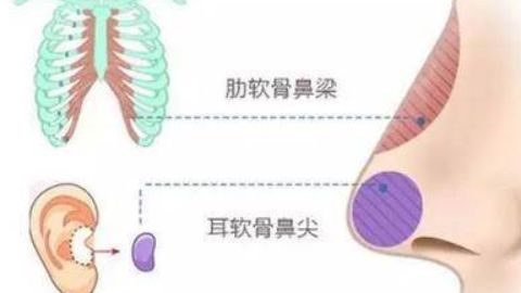 廣州有哪些醫(yī)院可以進(jìn)行抽脂手術(shù)？