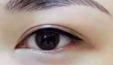 北京沃爾醫(yī)療美容診所醫(yī)生技術(shù)水平高嗎？午夜瓷雕超值口碑揭秘