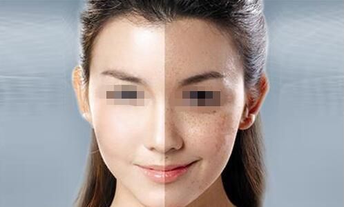 南昌哪家醫(yī)院做光子嫩膚好？選擇南昌哪家醫(yī)院光子嫩膚效果最佳