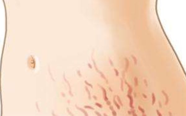 新鄉(xiāng)海迪醫(yī)療整形美容醫(yī)院值得信賴嗎？2023年價(jià)格表與醫(yī)生信息一覽