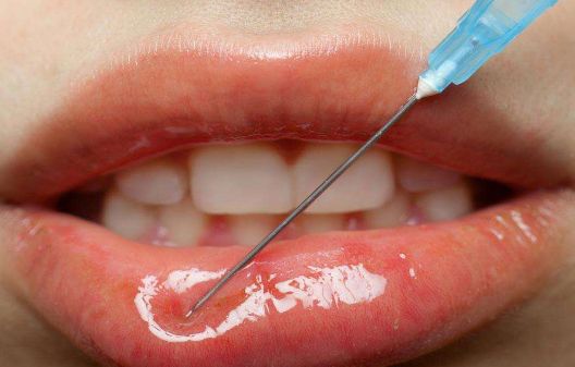 南京鼻梁塌醫(yī)院哪家好？南京鼻梁塌矯正醫(yī)院排名及選擇技巧分析