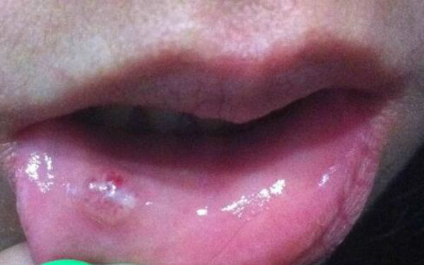 2023江蘇漏斗胸整形排行前十強(qiáng)的專家(黎葉、周守貴、王福生專業(yè)不踩雷)