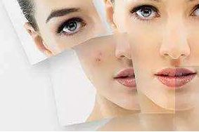 上海哪家醫(yī)院祛太田痣效果最佳？