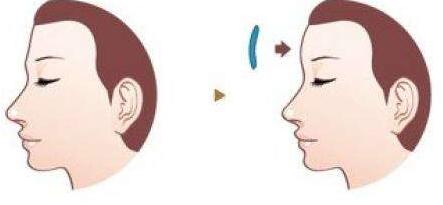 廣州整容行業(yè)的5位醫(yī)生，為你推薦熟悉整圈內(nèi)的大咖！