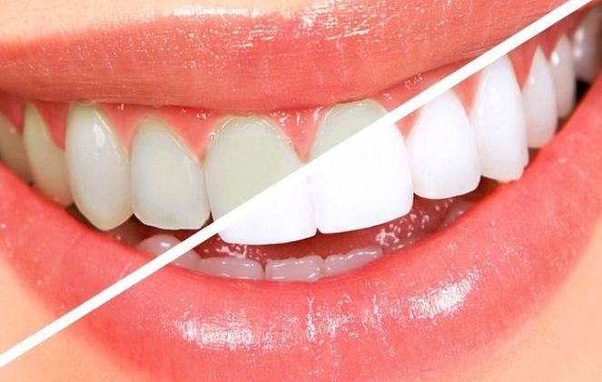 天津哪家醫(yī)院看鼻腔好？癥狀嚴(yán)重時如何尋找專業(yè)醫(yī)院治療？