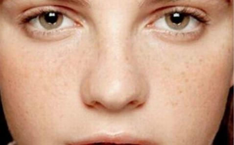 2023海南隆鼻用進(jìn)口假體醫(yī)生TOP10強(qiáng)上榜清單(劉記、姚志彬、于宏偉技術(shù)優(yōu)勢(shì)顯著)