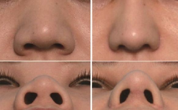 湖州市哪家醫(yī)院去疤痕好？專家推薦疤痕修復技術排行榜！