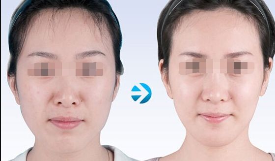 【2023北京哪家醫(yī)院做皮秒好？皮秒技術(shù)排行榜推薦】