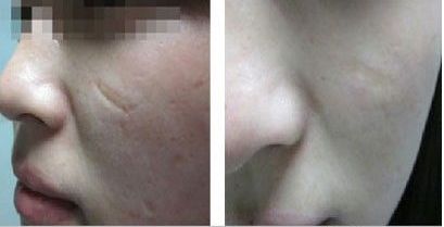 湖北棗陽整形醫(yī)院哪家最值得信賴？