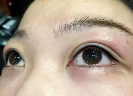 昆山有一家時(shí)光趙春飛整形醫(yī)院，雙眼皮效果怎么樣？整形費(fèi)用一覽表來(lái)了解。