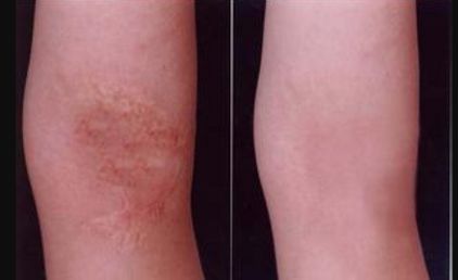 重慶整形醫(yī)院哪家效果好？權(quán)威排行榜來告訴你！