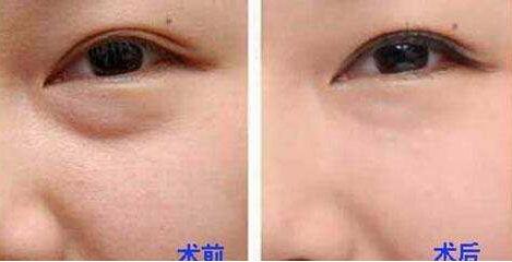 杭州整形美容界大咖PK，曾海峰、河?xùn)|鎬、高俊明，想知道磨骨哪個(gè)醫(yī)生靠譜？