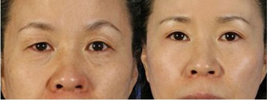 南京硅膠隆鼻哪家醫(yī)院好？斯景醫(yī)療專家推薦！