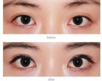 武漢處女膜修復哪家好？專業(yè)修復機構推薦詳細比較