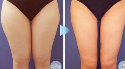 哪位醫(yī)生在北京八大處做拉皮手術效果好？馬繼光的資歷和費用情況有哪些？