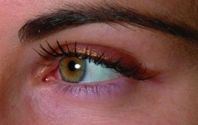 上海哪家醫(yī)院治療疤痕效果好？上海三甲疤痕醫(yī)院哪家最受歡迎？