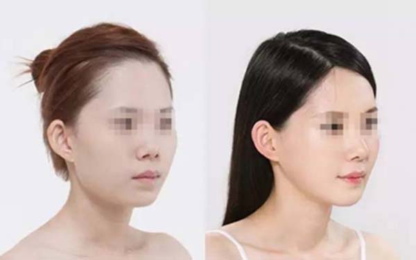 北京隆胸醫(yī)生排行：網友推薦的實力派、口碑出眾的美容專家值得關注