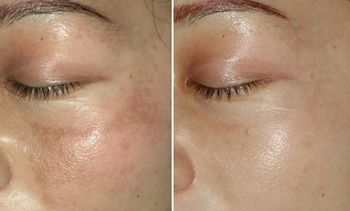 哈醫(yī)大二院整形科怎么樣？哈醫(yī)大二院整形科簡介|醫(yī)生團(tuán)隊(duì)|口碑評價(jià)！