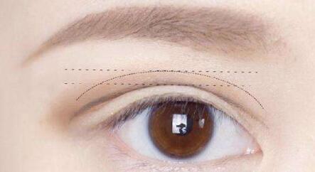 杭州劉軍鼻子塑形效果如何？個人簡介、醫(yī)院、費用詳情先給您解答