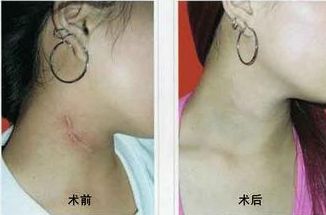 南寧哪家醫(yī)院治痘效果好？選擇明星們的美肌秘密推薦的南寧優(yōu)質(zhì)醫(yī)院