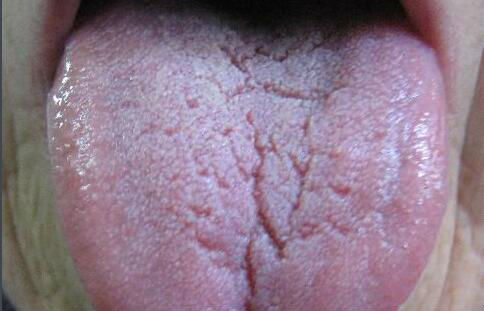 2023湛江溶脂去眼袋手術(shù)top10強(qiáng)醫(yī)生(朱本谷、趙璽耀、張俊優(yōu)質(zhì)醫(yī)美價(jià)格公道)