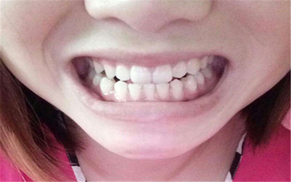 2023無錫水動力360°環(huán)形吸脂權(quán)威專家排名前10位(張若梅、余海龍、任天平入圍)