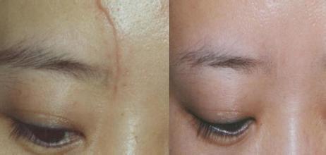 2023南京額頭皺紋快速消除專家前10名上榜清單(陳訓(xùn)、沈干、陳晨強(qiáng)勢(shì)推薦~)