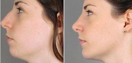 上?？簇惪损肽募裔t(yī)院好？選個(gè)靠譜的！