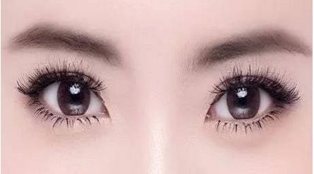 南寧自體填充淚溝哪家好？探索最佳南寧自體填充淚溝選擇