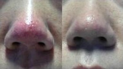 福州哪家醫(yī)生做隆胸技術(shù)好？推薦五位專業(yè)醫(yī)師，價(jià)格參考！