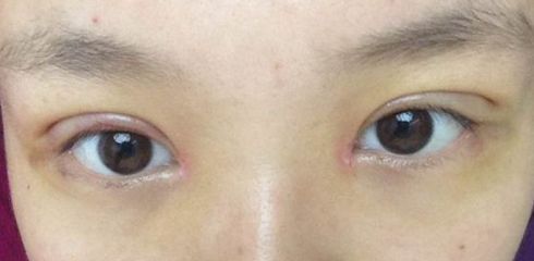 徐州做拉皮哪家醫(yī)院好？一起來看看徐州市最受歡迎的做拉皮醫(yī)院