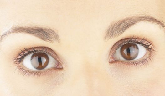 南寧哪家祛痘的醫(yī)院好？找到最適合您的祛痘專家！