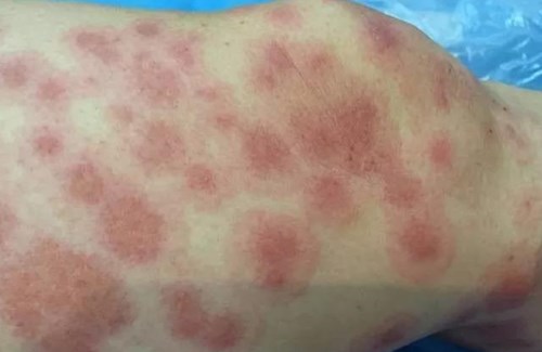 杜太超的鼻部整形效果驚艷，細節(jié)設(shè)計精湛！或杜太超的鼻子整形術(shù)成功塑造出迷人的面容